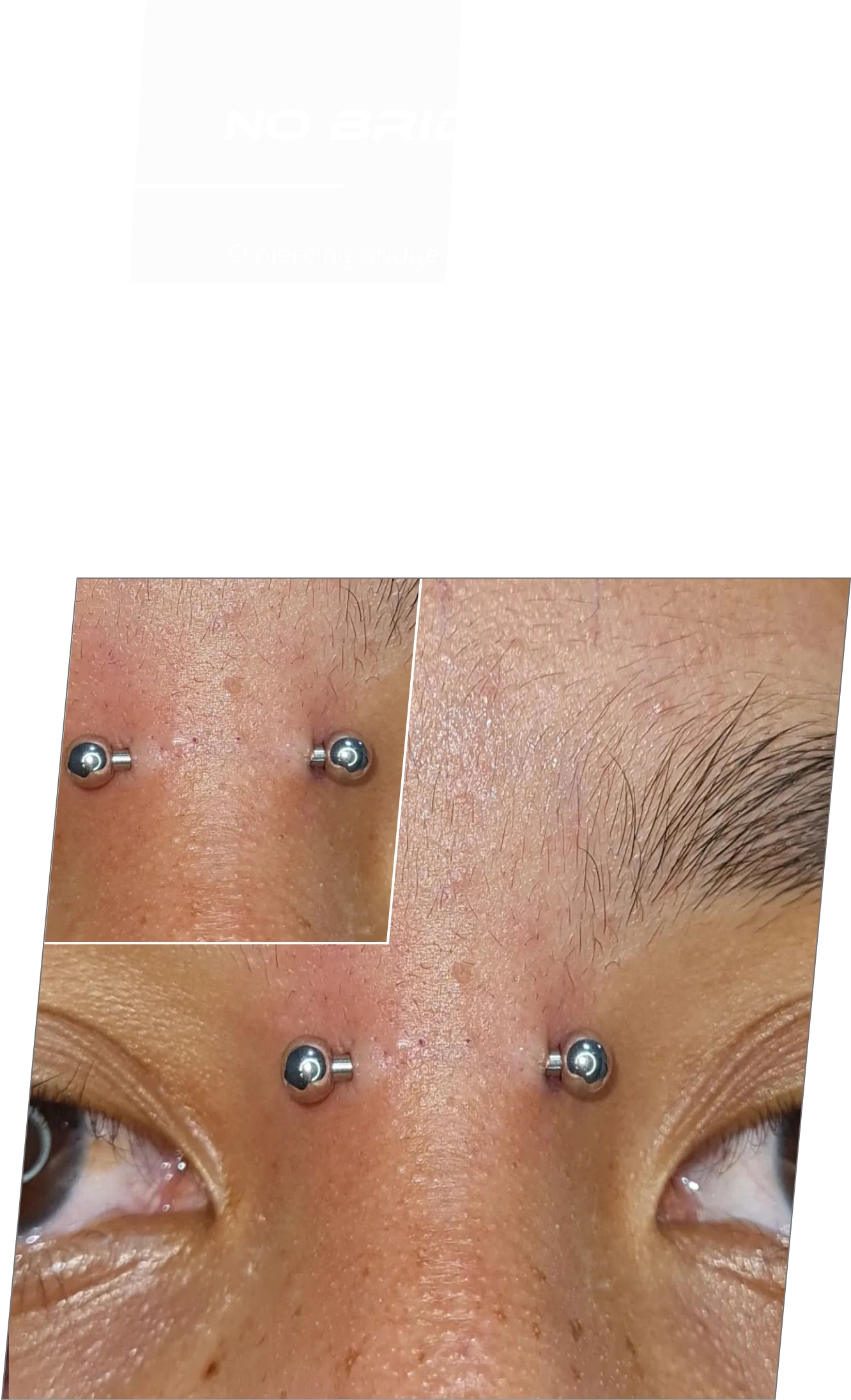 Exemplo de aplicação de piercing Bridge