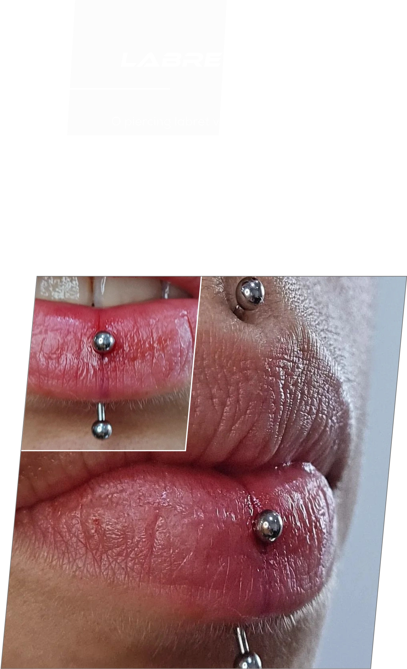 Exemplo de aplicação de piercing Labret Vertical