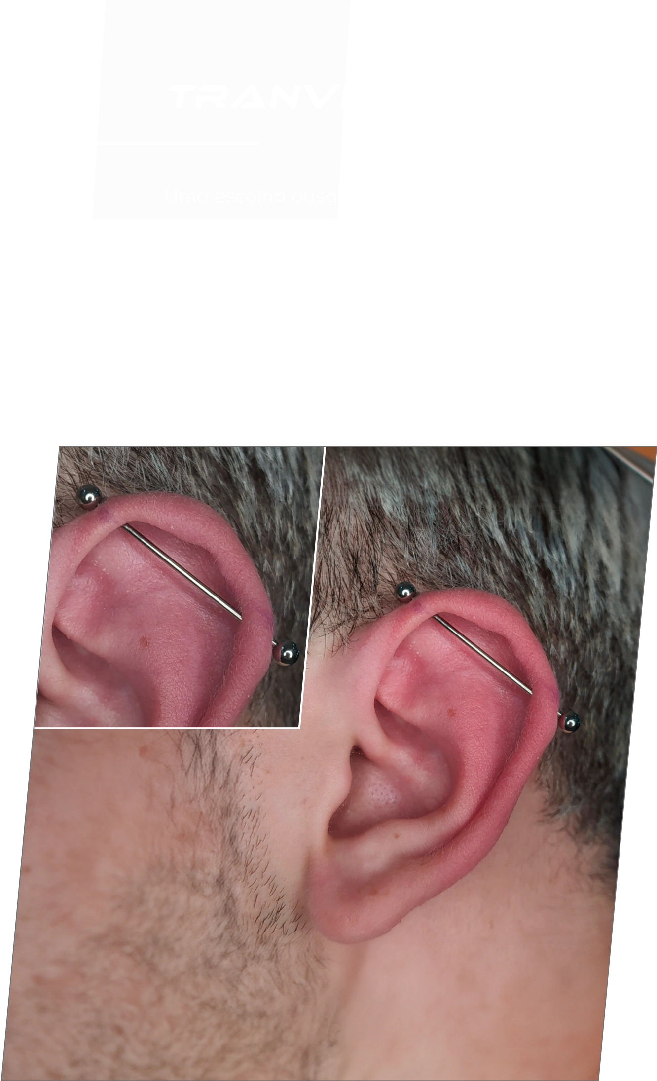 Exemplo de aplicação de piercing Transversal